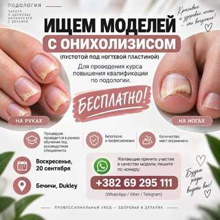 🦶 ИЩЕМ МОДЕЛЕЙ С ОНИХОЛИЗИСОМ